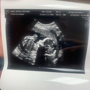 Meet your Posher, Mesha